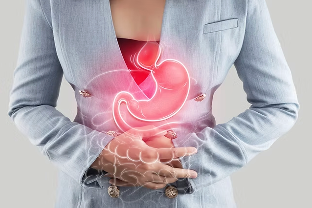 stomach reflux picture